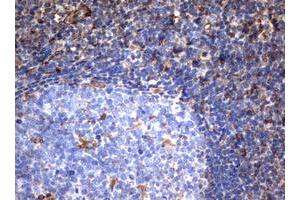 Image no. 2 for anti-Vimentin (VIM) (AA 210-466) antibody (ABIN1491200) (Vimentin antibody  (AA 210-466))