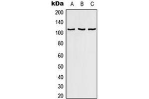 Western blot analysis of RAB3GAP1 expression in HeLa (A), SP2/0 (B), PC12 (C) whole cell lysates. (RAB3GAP1 antibody  (Center))