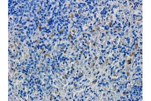 Immunohistochemical staining of rat spleen tissue using anti-CD19 antibody FMC63. (Recombinant CD19 antibody)