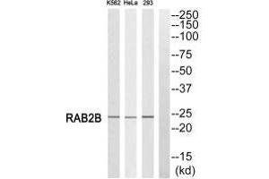 Western blot analysis of extracts from K562 cells, HeLa cells and 293 cells, using RAB2B antibody. (RAB2B antibody)
