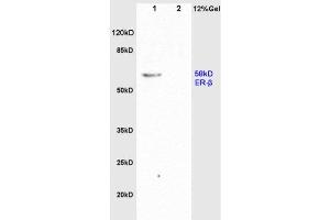 L1 rat brain, L2 rat colon lysates probed  at 1:200 in 4˚C. (Estrogen Receptor alpha + beta (AA 201-300) antibody)