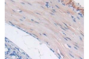 Detection of GaA in Mouse Small intestine Tissue using Polyclonal Antibody to Glucosidase Alpha, Acid (GaA) (GAA antibody  (AA 755-953))