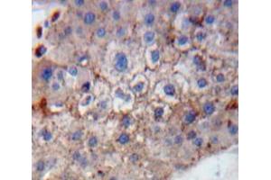 Used in DAB staining on fromalin fixed paraffin-embedded Liver tissue (GP1BB antibody  (AA 53-176))