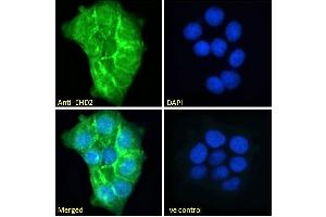 ABIN185287 Immunofluorescence analysis of paraformaldehyde fixed A431 cells, permeabilized with 0.