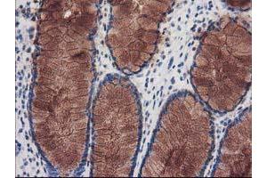 Immunohistochemical staining of paraffin-embedded Human colon tissue using anti-KATNB1 mouse monoclonal antibody. (KATNB1 antibody)