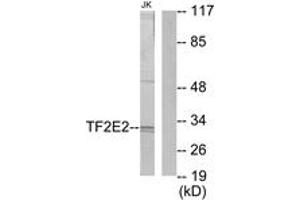 Western blot analysis of extracts from Jurkat cells, using TF2E2 Antibody. (GTF2E2 antibody  (AA 151-200))