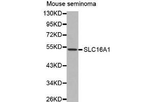Western Blotting (WB) image for anti-Solute Carrier Family 16, Member 1 (Monocarboxylic Acid Transporter 1) (SLC16A1) antibody (ABIN6219986) (SLC16A1 antibody)