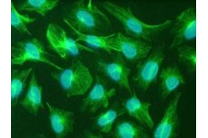 Immunfluorescence staining of the human glioma cell line U251. (Nestin antibody)