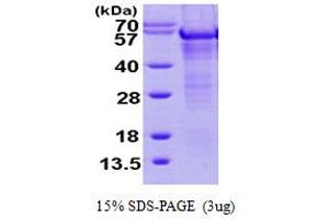 SDS-PAGE (SDS) image for TNFAIP3 Interacting Protein 1 (TNIP1) (AA 94-530) protein (His tag) (ABIN6386636)