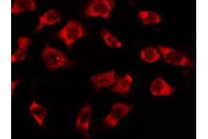 ABIN6278608 staining MCF7 by IF/ICC. (OR3A2/3 antibody)