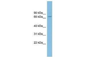 EIF4B antibody used at 1 ug/ml to detect target protein. (EIF4B antibody  (Middle Region))