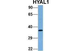 Host:  Rabbit  Target Name:  HYAL1  Sample Type:  Human Fetal Lung  Antibody Dilution:  1. (HYAL1 antibody  (N-Term))