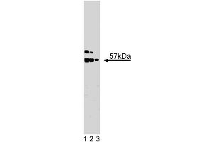 Western blot analysis of hILP/XIAP on Jurkat lysate. (XIAP antibody  (AA 268-426))