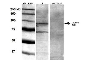 Western Blot analysis of Rat brain membrane lysate showing detection of GIT1 protein using Mouse Anti-GIT1 Monoclonal Antibody, Clone S39B-8 . (GIT1 antibody  (AA 375-770))