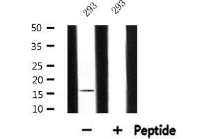 Western blot analysis of extracts from 293, using MRPL14 Antibody. (MRPL14 antibody  (C-Term))
