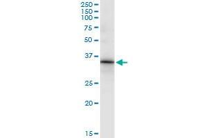 Immunoprecipitation of HOXC8 transfected lysate using anti-HOXC8 monoclonal antibody and Protein A Magnetic Bead , and immunoblotted with HOXC8 MaxPab rabbit polyclonal antibody. (HOXC8 antibody  (AA 47-136))