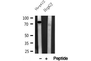 Western blot analysis of extracts of HepG2 cells, using CPT1A antibody. (CPT1A antibody  (Internal Region))