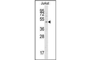 Western blot analysis of ATG4A Antibody  in Jurkat cell line lysates (35ug/lane).