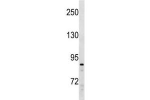 SUZ12 antibody western blot analysis in Ramos lysate. (SUZ12 antibody  (AA 559-588))
