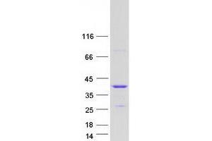 Western Blotting (WB) image for Heterogeneous Nuclear Ribonucleoprotein A0 (HNRNPA0) protein (Myc-DYKDDDDK Tag) (ABIN2722907)
