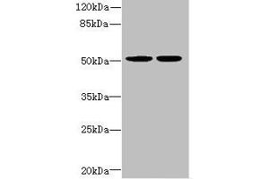 Western blot All lanes: MATK antibody at 5. (MATK antibody  (AA 393-507))