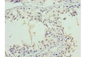 Immunohistochemistry of paraffin-embedded human testis tissue using ABIN7171128 at dilution of 1:100