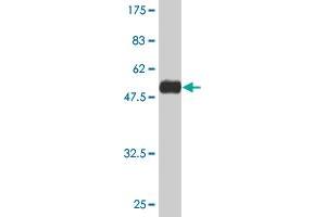 Western Blot detection against Immunogen (47. (RAB22A antibody  (AA 1-194))