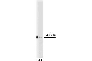 Western blot analysis of prostasin on a LNCaP-FGC-10 (human prostate cancer cell line) lysate.