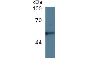 Western blot analysis of Human Hela cell lysate, using Rabbit Anti-Rat KNG1 Antibody (5 µg/ml) and HRP-conjugated Goat Anti-Rabbit antibody (abx400043, 0.