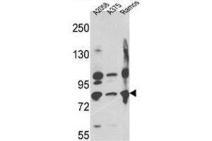 Western blot analysis of Neprilysin Antibody (C-term) in A2058,A375,Ramos cell line lysates (35ug/lane). (MME antibody  (C-Term))