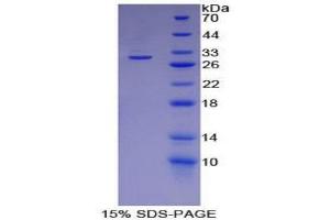 SDS-PAGE (SDS) image for Basigin (Ok Blood Group) (BSG) (AA 87-323) protein (His tag,T7 tag) (ABIN1879117) (CD147 Protein (AA 87-323) (His tag,T7 tag))