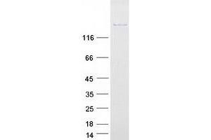 Validation with Western Blot (AQR Protein (Myc-DYKDDDDK Tag))