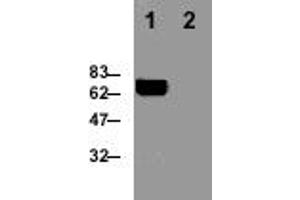 Detection of perforin in the mouse T cell clone B6. (Perforin 1 antibody  (AA 98-534))