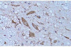 Immunohistochemistry of paraffin-embedded Rat spinal cord using HADH Polyclonal Antibody at dilution of 1:100 (40x lens). (HADH antibody)