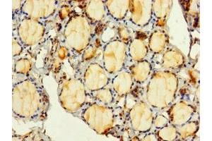 Immunohistochemistry of paraffin-embedded human thyroid tissue using ABIN7149332 at dilution of 1:100