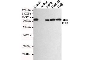 Western blot detection of BTK in Daudi,Jurkat(BTK negative),K562,Ramos and Raji cell lysates using BTK mouse mAb (1:1000 diluted). (BTK antibody)