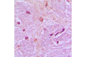 Immunohistochemical analysis of TBX15/18 staining in human brain formalin fixed paraffin embedded tissue section. (T-Box 15/18 antibody  (Center))