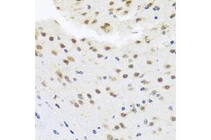 Immunohistochemistry of paraffin-embedded mouse brain using HD antibody (ABIN6128012, ABIN6141669, ABIN6141672 and ABIN6213648) at dilution of 1:100 (40x lens). (HDAC4 antibody  (AA 451-650))