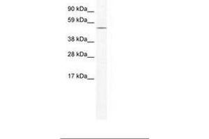 Image no. 1 for anti-Nuclear Receptor Subfamily 5, Group A, Member 1 (NR5A1) (AA 358-407) antibody (ABIN202579) (NR5A1 antibody  (AA 358-407))
