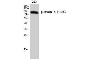 Western Blotting (WB) image for anti-Insulin Receptor (INSR) (pTyr1355) antibody (ABIN3182541) (Insulin Receptor antibody  (pTyr1355))