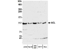 Western Blotting (WB) image for anti-ATP Citrate Lyase (ACLY) (AA 350-400) antibody (ABIN7449939) (ACLY antibody  (AA 350-400))