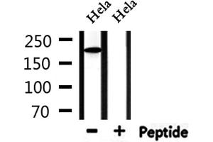 Western blot analysis of extracts from Hela, using Collagen Valpha 1 Antibody.