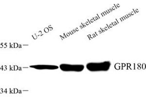 Western blot analysis of GPR180 (ABIN7073998) at dilution of 1: 1000 (GPR180 antibody)