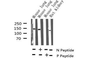 Western blot analysis of Phospho-Met (Tyr1234) expression in various lysates (c-MET antibody  (pTyr1234))