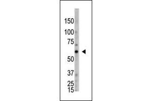 The anti-OASL C-term Antibody (ABIN390168 and ABIN2840664) is used in Western blot to detect OASL in HL60 lysate. (OASL antibody  (C-Term))