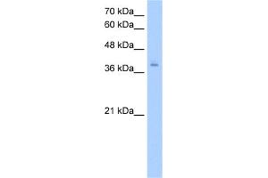 WB Suggested Anti-PCBP2 Antibody Titration:  2. (PCBP2 antibody  (N-Term))