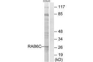 Western blot analysis of extracts from COLO cells, using RAB6C antibody. (WTH3DI antibody  (Internal Region))