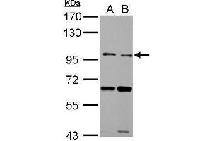 WB Image TLR5 antibody detects TLR5 protein by Western blot analysis.