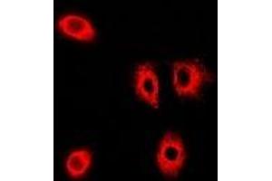 Immunofluorescent analysis of PIST staining in A549 cells. (GOPC antibody)