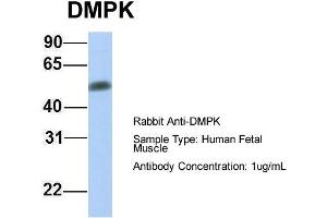 Host:  Rabbit  Target Name:  DMPK  Sample Type:  Human Fetal Muscle  Antibody Dilution:  1. (DMPK antibody  (Middle Region))